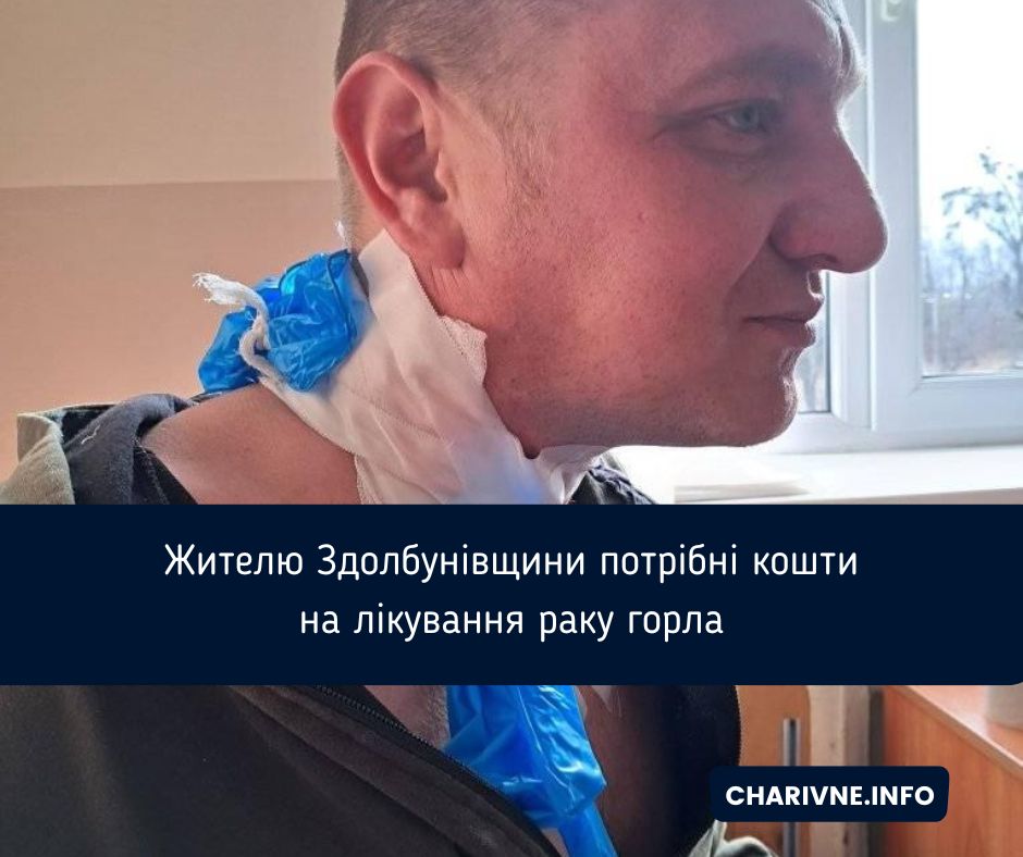 Фото ілюстративне